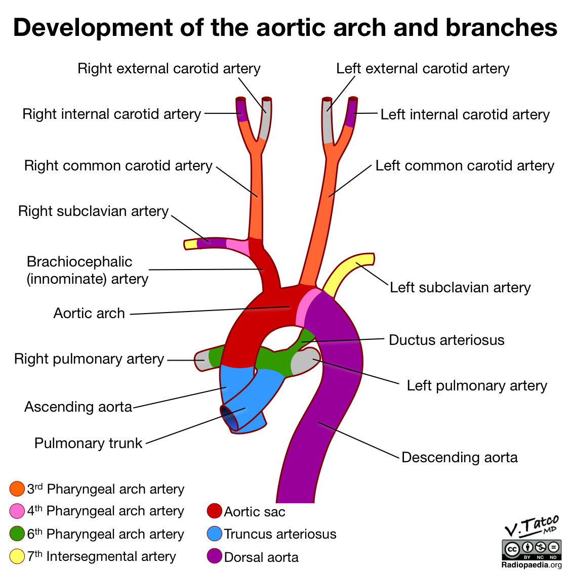 Radiopaedia Drawing Development Of The Aortic Arch And Branches After Weeks English Labels